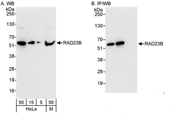 Rabbit anti-RAD23B Antibody, Affinity Purified