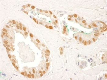 Rabbit anti-RAD23B Antibody, Affinity Purified