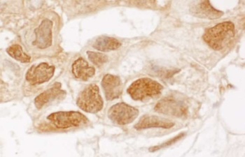 Rabbit anti-TIGAR Antibody, Affinity Purified
