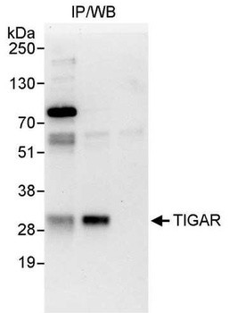 Rabbit anti-TIGAR Antibody, Affinity Purified