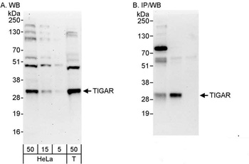 Rabbit anti-TIGAR Antibody, Affinity Purified