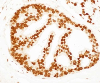 Rabbit anti-SET Antibody, Affinity Purified