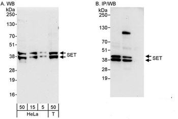 Rabbit anti-SET Antibody, Affinity Purified