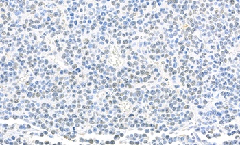 Rabbit anti-SET Antibody, Affinity Purified