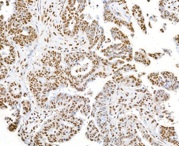 Rabbit anti-SET Antibody, Affinity Purified