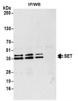 Rabbit anti-SET Antibody, Affinity Purified