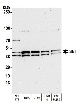 Rabbit anti-SET Antibody, Affinity Purified