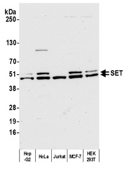 Rabbit anti-SET Antibody, Affinity Purified