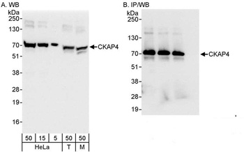Rabbit anti-CKAP4 Antibody, Affinity Purified