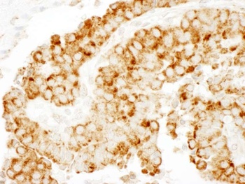 Rabbit anti-CKAP4 Antibody, Affinity Purified