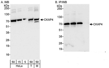 Rabbit anti-CKAP4 Antibody, Affinity Purified