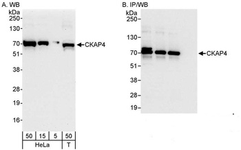 Rabbit anti-CKAP4 Antibody, Affinity Purified