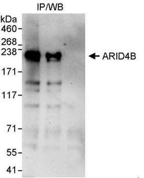 Rabbit anti-ARID4B Antibody, Affinity Purified