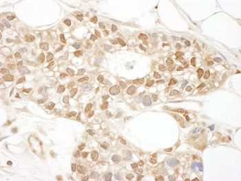 Rabbit anti-MKL1 Antibody, Affinity Purified