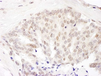 Rabbit anti-Cul5 Antibody, Affinity Purified