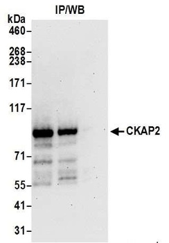Rabbit anti-CKAP2 Antibody, Affinity Purified