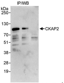 Rabbit anti-CKAP2 Antibody, Affinity Purified