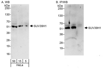 Rabbit anti-SUV39H1 Antibody, Affinity Purified