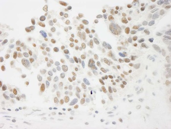 Rabbit anti-THOC5 Antibody, Affinity Purified