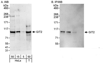 Rabbit anti-GIT2 Antibody, Affinity Purified