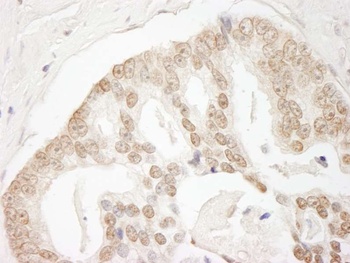 Rabbit anti-GIT2 Antibody, Affinity Purified