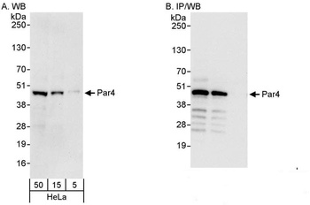 Rabbit anti-Par4 Antibody, Affinity Purified