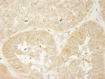 Rabbit anti-LARP1 Antibody, Affinity Purified
