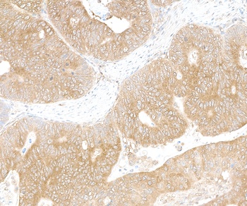 Rabbit anti-LARP1 Antibody, Affinity Purified