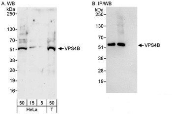 Rabbit anti-VPS4B Antibody, Affinity Purified
