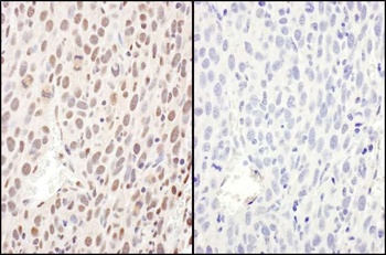 Rabbit anti-Phospho RelA (S468) Antibody, Affinity Purified
