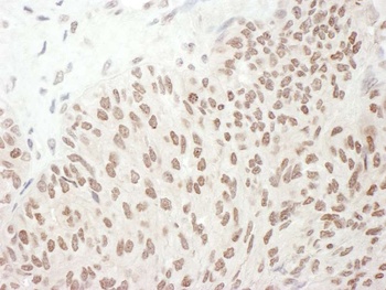 Rabbit anti-Phospho RelA (S468) Antibody, Affinity Purified