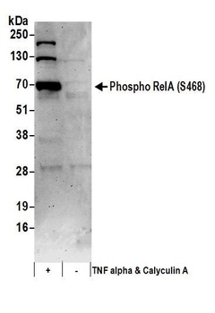 Rabbit anti-Phospho RelA (S468) Antibody, Affinity Purified