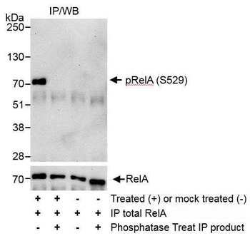 Rabbit anti-Phospho RelA (S529) Antibody, Affinity Purified