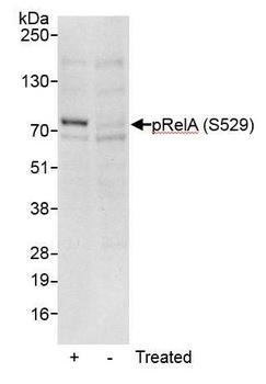 Rabbit anti-Phospho RelA (S529) Antibody, Affinity Purified