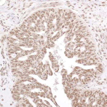 Rabbit anti-Phospho RelA (S536) Antibody, Affinity Purified