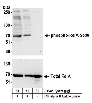 Rabbit anti-Phospho RelA (S536) Antibody, Affinity Purified