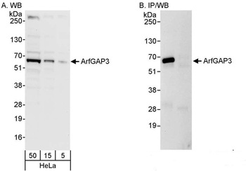 Rabbit anti-ArfGAP3 Antibody, Affinity Purified