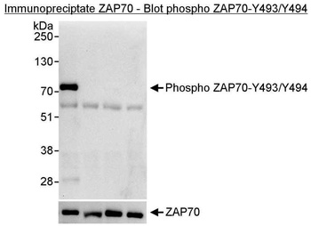 Rabbit anti-Phospho ZAP70 (Y493/Y494) Antibody, Affinity Purified