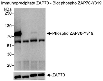 Rabbit anti-Phospho ZAP70 (Y319) Antibody, Affinity Purified
