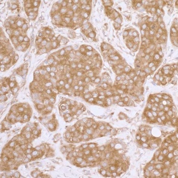 Rabbit anti-eIF3A/eIF3S10 Antibody, Affinity Purified