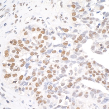 Rabbit anti-BRD4 Antibody, Affinity Purified