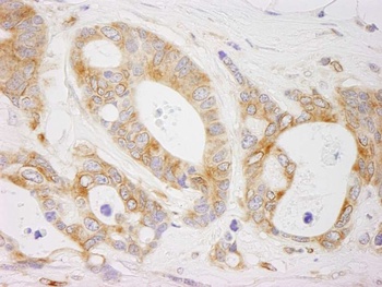 Rabbit anti-EML4 Antibody, Affinity Purified