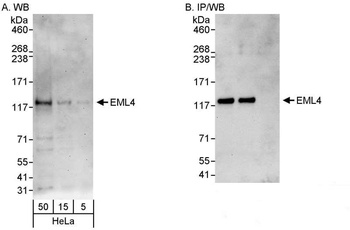 Rabbit anti-EML4 Antibody, Affinity Purified
