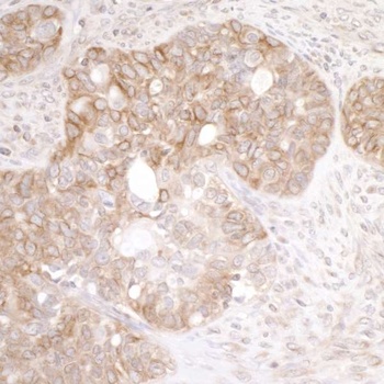 Rabbit anti-EML4 Antibody, Affinity Purified