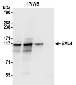 Rabbit anti-EML4 Antibody, Affinity Purified