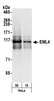 Rabbit anti-EML4 Antibody, Affinity Purified