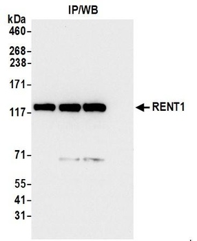 Rabbit anti-RENT1 Antibody, Affinity Purified