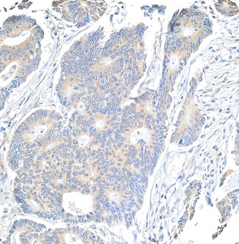 Rabbit anti-Notch1 Antibody, Affinity Purified