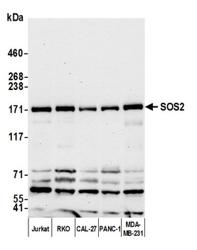 Rabbit anti-SOS2 Antibody, Affinity Purified