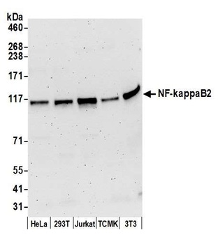 Rabbit anti-NF-kappaB2 Antibody, Affinity Purified